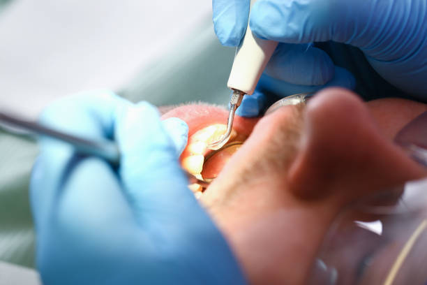 Best Emergency Tooth Extraction in Posen, IL