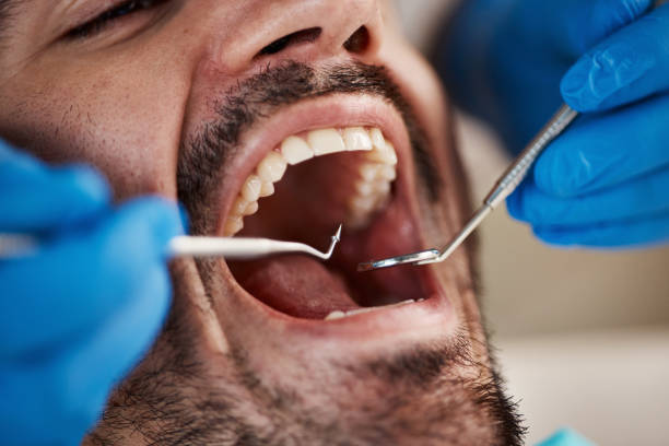 Best Walk-In Emergency Dentist in Posen, IL